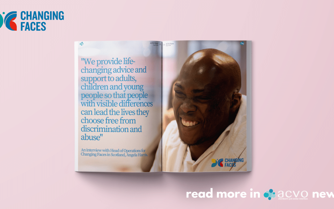 Changing Faces – ACVO News article